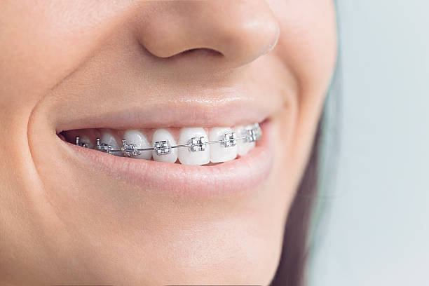 Best Invisalign and Clear Aligners  in Olivet, NJ